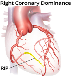 Right coronary artery dominant heart