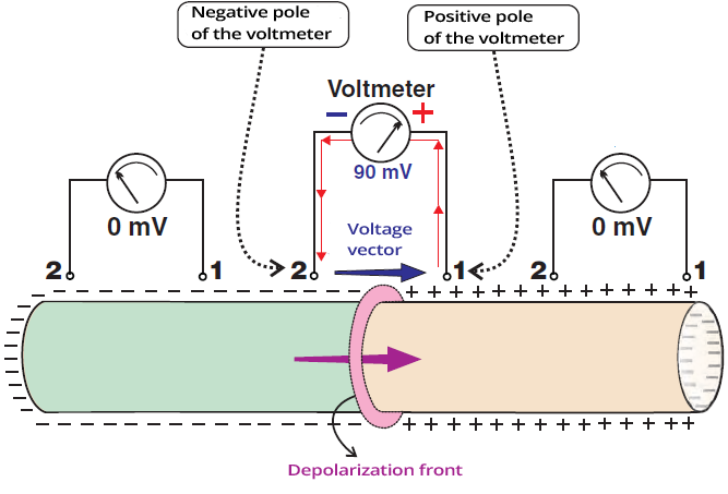 Recording a voltage action potential by external electrodes