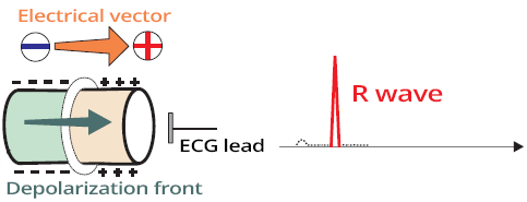 Fast spread depolarization wave, electrical vector and R wave