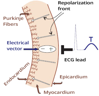 Myocardial wall repolarization from epicardium to endocardium