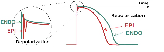 synchronous depolarization with notch, and asynchronous repolarization wave of action potentials in endocardium and epicardium