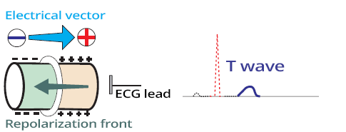 Slow spread repolarization wave, electrical vector and T wave