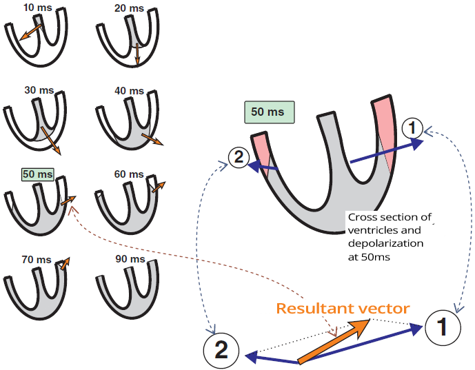 Main resultant electrical vector during ventricular depolarization