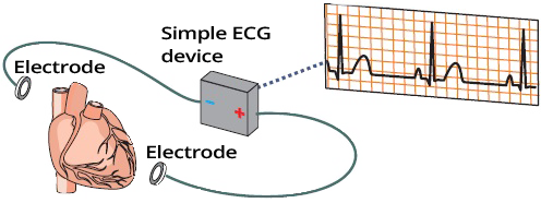 ecg electrodes, voltmeter and ecg paper