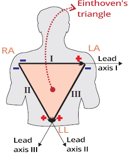 Einthoven's equilateral triangle with ECG electrodes and leads