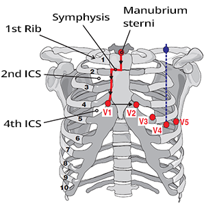 ECG chest electrodes and locating 4th intercostal space