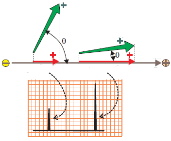 The magnitude of the deflection. Angle between vector and lead axis