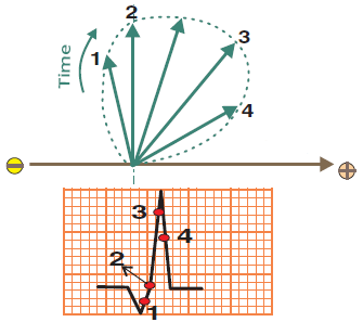 ECG Curve Mechanism - ECG book