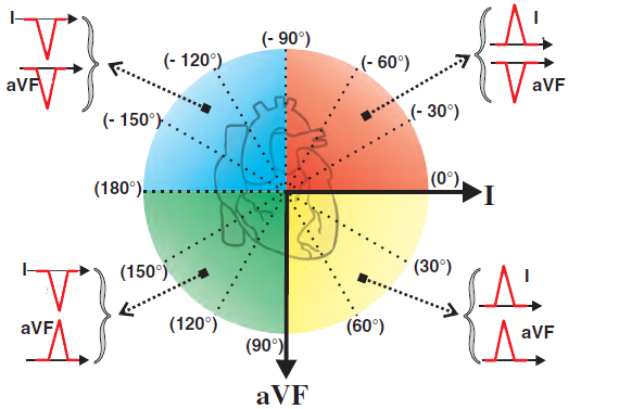 Leads I and aVF divide the thorax into 4 electrical quadrants