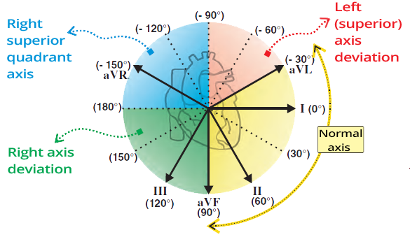 Right superior quadrant axis, Right axis deviation, Normal - Intermediate axis, Left superior axis deviation