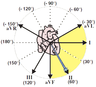 Electrical vector and normal heart axis