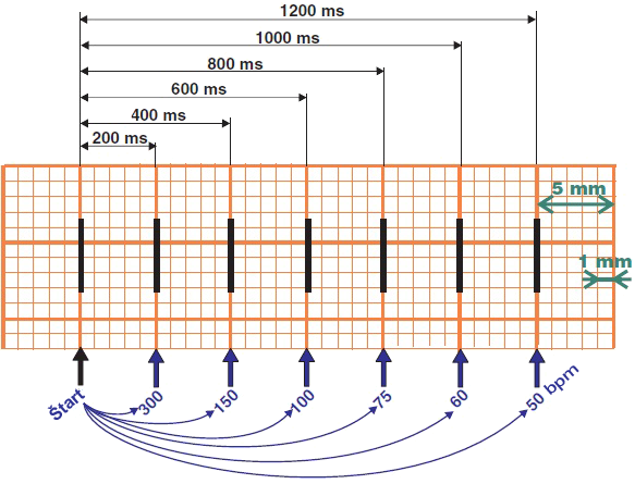 Heart rate rapid determination. Calculation (300 - 150 - 100 - 75 - 60 - 50)