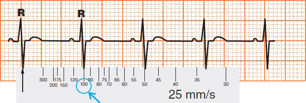 Cardiac ruler method for determining the heart rate