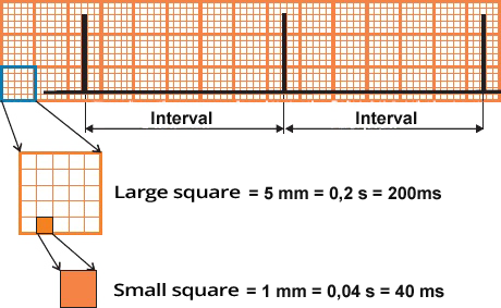 ECG interval vs. rate, large square, small square