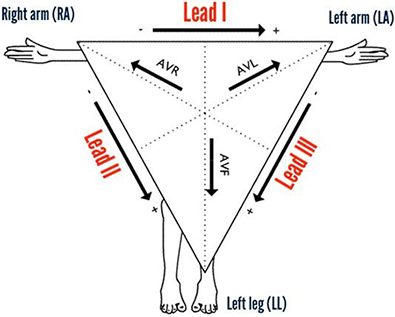 Einthoven triangle, Wilson central terminal - electrical center of heart, limb leads and electrodes