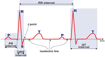 ECG intervals: RR interval, QRS interval, QT interval, isoelectric line