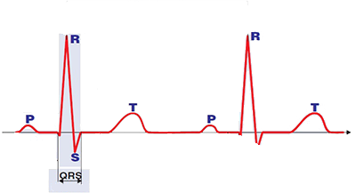 ECG QRS interval represents the duration of ventricular depolarization, contains Q wave, R wave, S wave