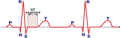 ECG segment