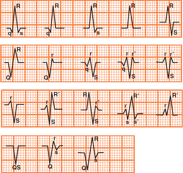 QRS complex terminology, nomenclature, and correct interpretation