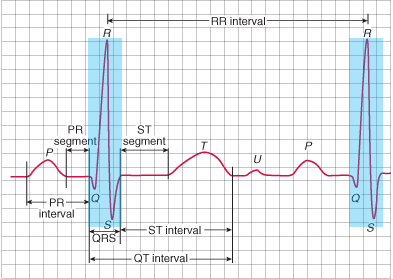 Normal QRS complex width and duration