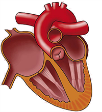 Right atrial hypertrophy, abnormality, dilatation, distention, overload