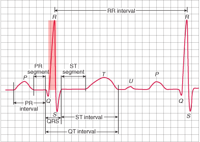 R Wave - ECG book