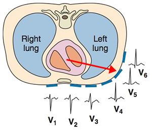 Main electrical vector direction and RS transition zone, R wave amplitude, axis in chest leads