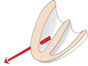 Dextrocardia and direction of heart electrical vector