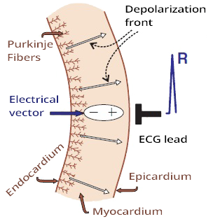 Myocardial wall depolarization from endocardium to epicardium and R wave