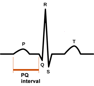 PR (PQ) interval from onset P wave to start of QRS complex