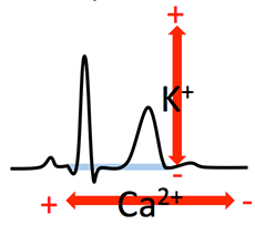 ECG changes hypercalcemia, hypocalcemia, hyperkalemia, hypokalemia, T wave, QT interval