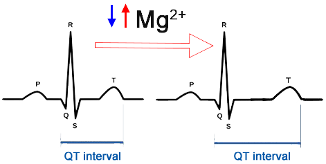 ECG changes hypermagnesaemia, hypomagnesaemia, prolonged QT interval