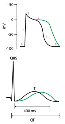 ECG normal QT, and prolonged QT interval