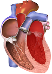 Normal myocardium, left ventriculi