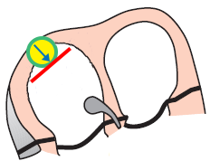 Sinoatrial node, P and T cells