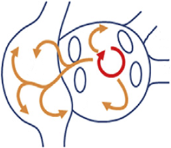 Atrial fibrillation, mother rotors re-entry, multiple wavelet mechanism