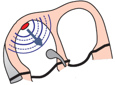 Primary pacemaker - SA node, AV node, sinus rhythm