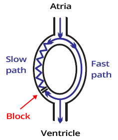 AV node, 2 electric pathways (a slow paced and a fast paced pathway)