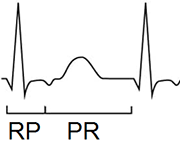 slow slow avnrt, rp pr interval