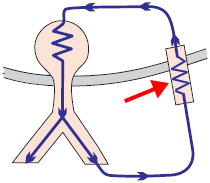 Decremental conduction, Permanent (Persistent) Junctional Reciprocating Tachycardia (PJRT), Coumel tachycardia