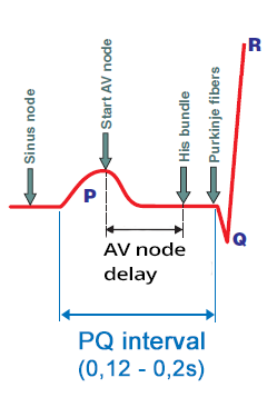 AV junction delay, P wave, PR segment, PR interval, Q wave, R wave