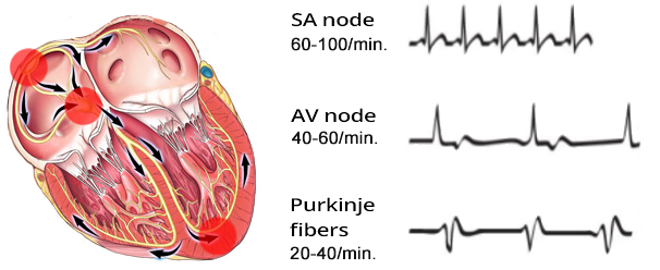 heart rhythm mechanism, sinus rhythm, junctional rhythm, ventricular rhythm