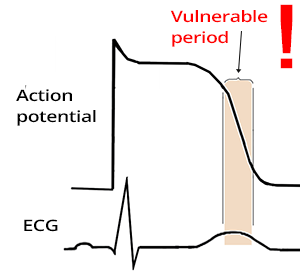 ECG, action potential, vulnerable period