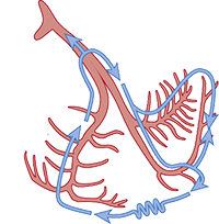 Bundle Branch Reentry Tachycardia Type B, anterograde retrograde conduction