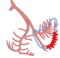 Interfascicular reentry with anterograde and retrograde conduction