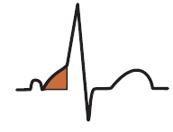 ECG delta wave, short PR interval