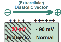 Diastolic extracellular ischemic vector