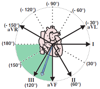 Electrical vector and right axis deviation, cor pulmonale, pulmonary embolism