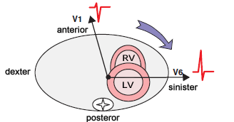 Clockwise (CW) rotation, Delayed transition zone, Late transition zone