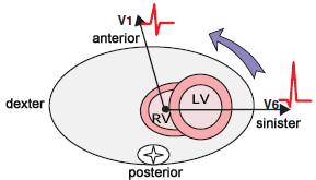 Counterclockwise (CCW) rotation, Early transition zone (V1, V2)